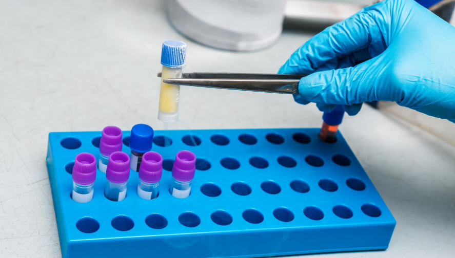 細(xì)胞凍存 細(xì)胞凍存